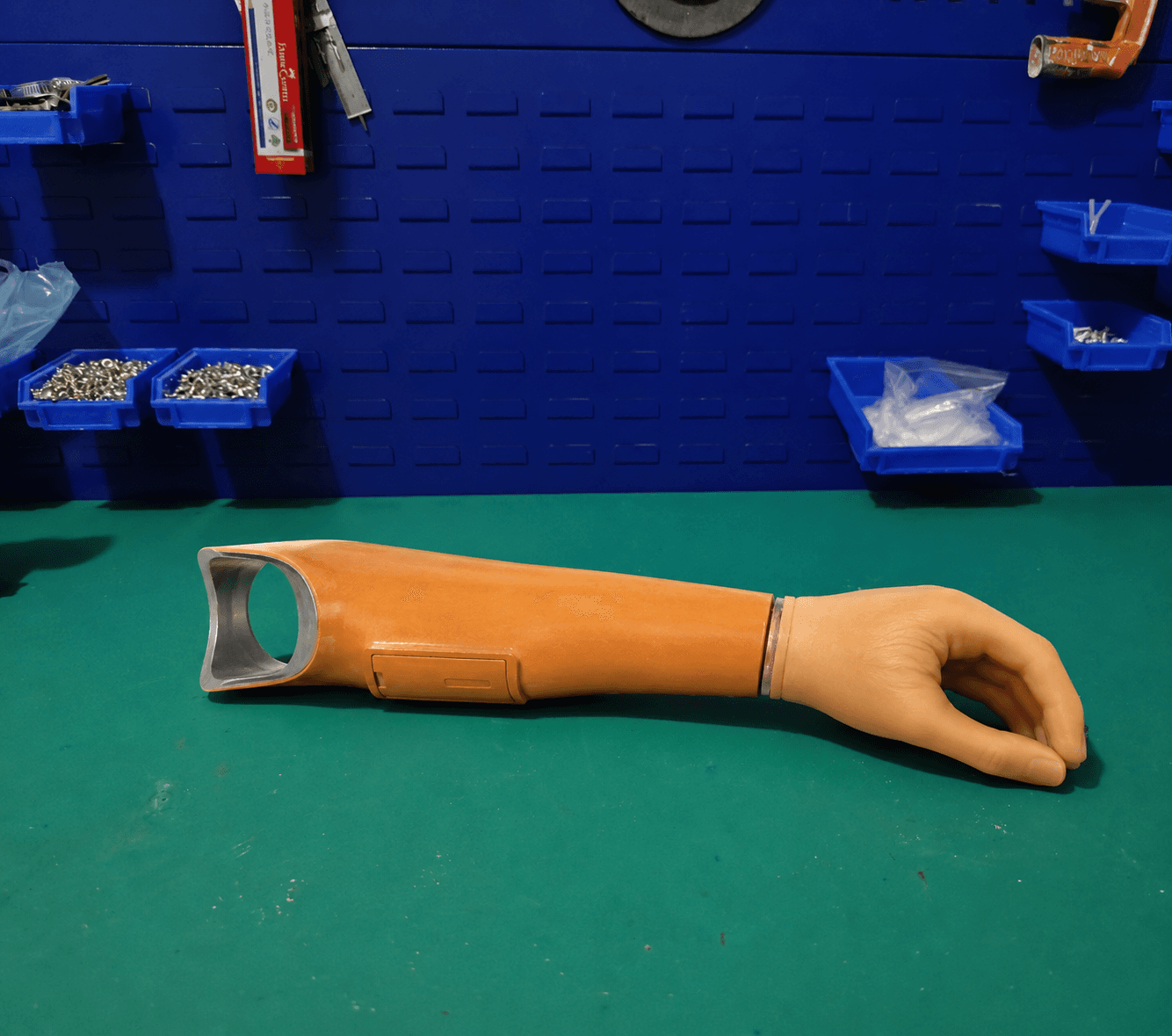 Upper limb prosthesis consultation at Cornerstone P&O